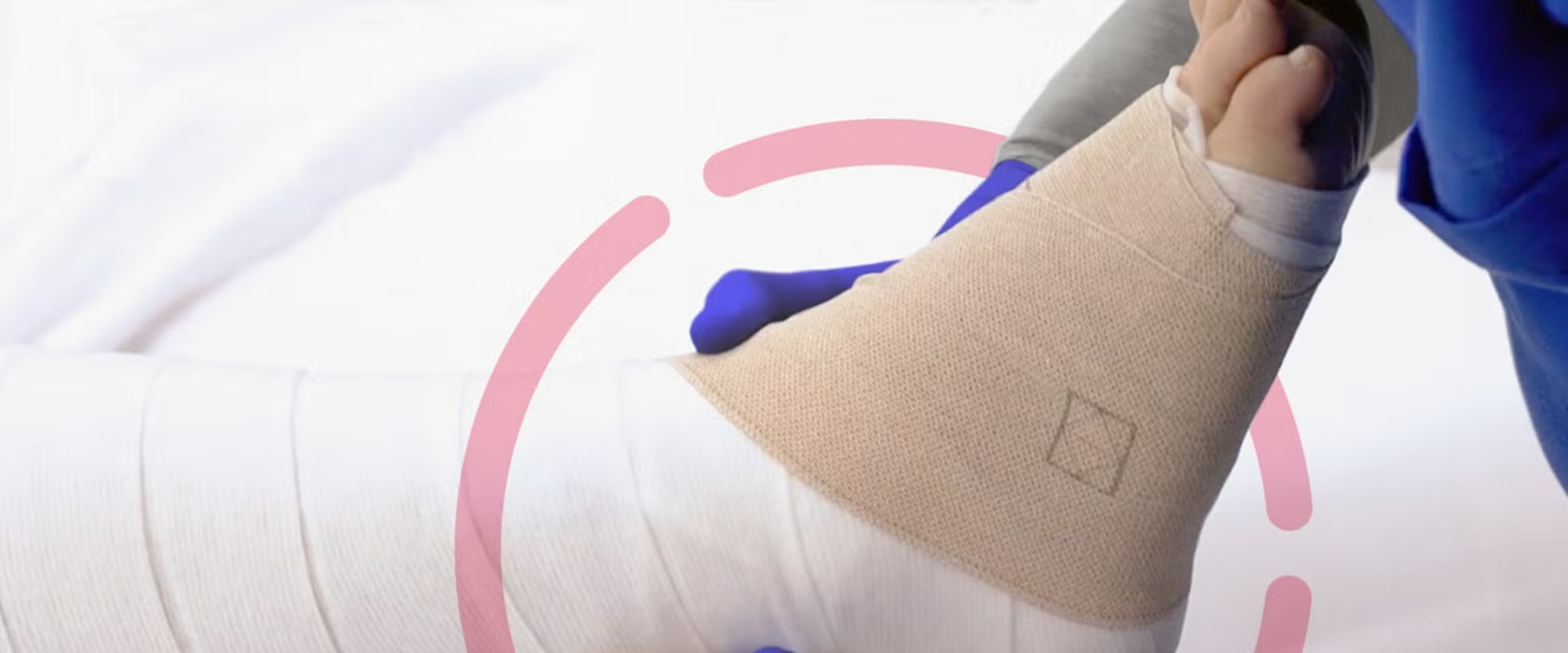 Unna Boot Application Tips to Reduce Pain & Improve Leg Mobility