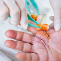 Granulation Tissue Pictures and Wound Healing Explained: What Healthy Granulation Looks Like vs. Signs of Delayed Recovery