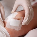 What Does a Healing Wound Smell Like? Clues to Healthy or Problem Recovery