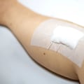 Healing Process Uncovered What Functions Do Clotting and Epithelial Cells Have in Repair