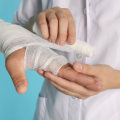 Iodoform Packing Techniques You Must Know for Safe Healing