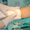 Granulation Tissue vs Slough: Wound Care Made Simple
