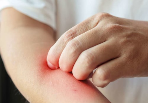 Is Itching a Sign of Healing? Everything You Need to Know About That Tingling Sensation After Injury