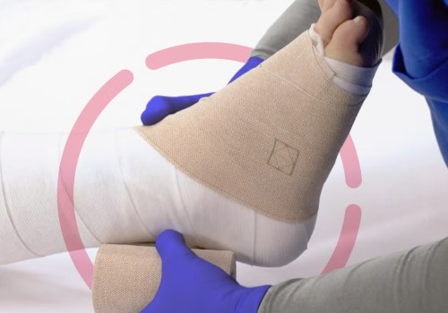 Unna Boot Application Tips to Reduce Pain & Improve Leg Mobility