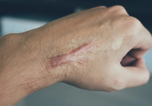 Want Smooth Skin by Morning? How to Heal Cuts Faster Overnight