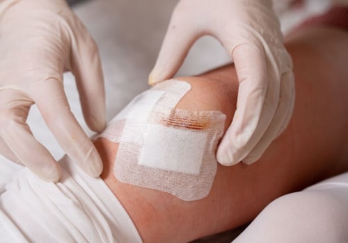 What Does a Healing Wound Smell Like? Clues to Healthy or Problem Recovery