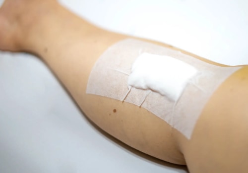 Healing Process Uncovered What Functions Do Clotting and Epithelial Cells Have in Repair